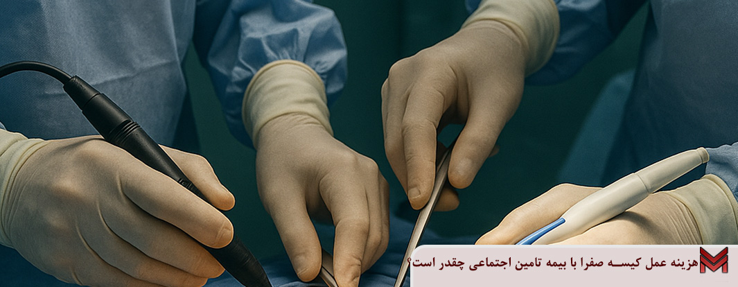 هزینه عمل کیسه صفرا با بیمه تامین اجتماعی چقدر است؟