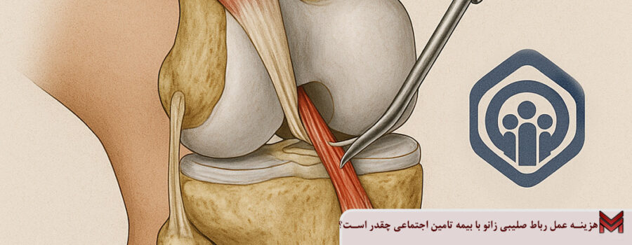 هزینه عمل رباط صلیبی زانو با بیمه تامین اجتماعی چقدر است؟