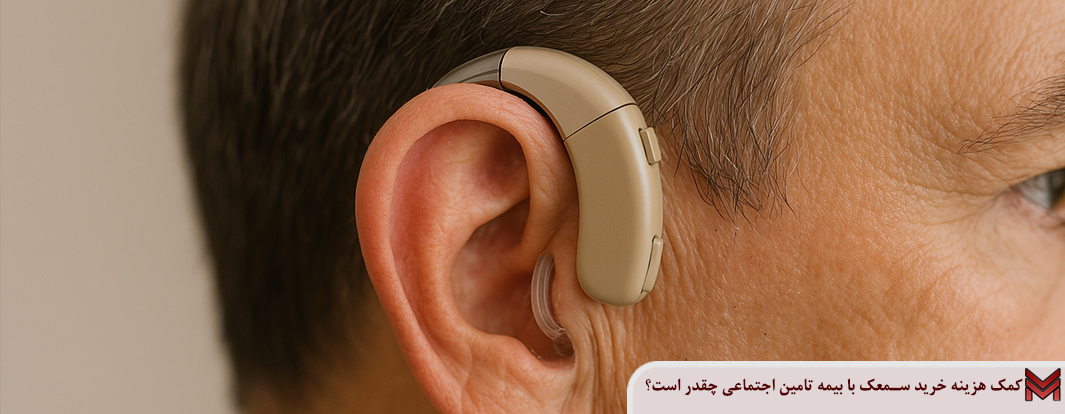 کمک هزینه خرید سمعک با بیمه تامین اجتماعی چقدر است؟