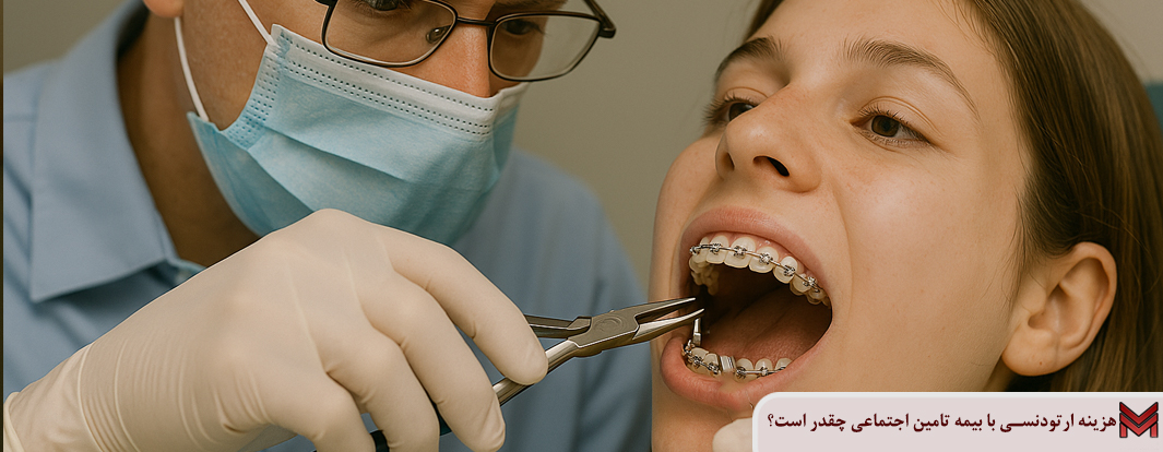 هزینه ارتودنسی با بیمه تامین اجتماعی چقدر است؟