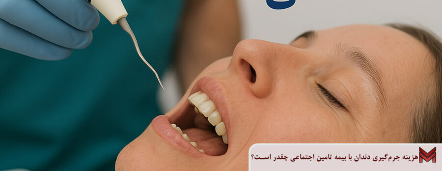 هزینه جرم‌گیری دندان با بیمه تامین اجتماعی چقدر است؟
