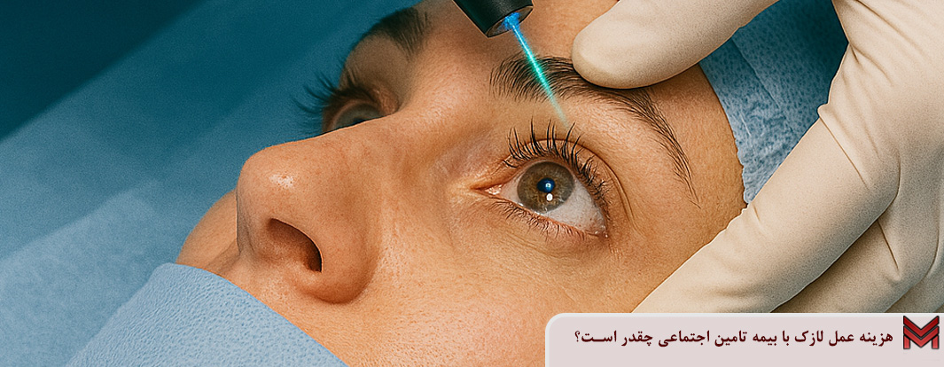 هزینه عمل لازک با بیمه تامین اجتماعی چقدر است؟