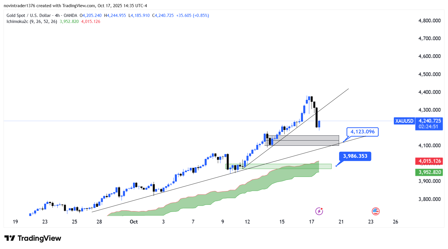 تحلیل انس در تایم فریم 4 ساعته 26 مهر
